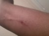 bite2.jpg